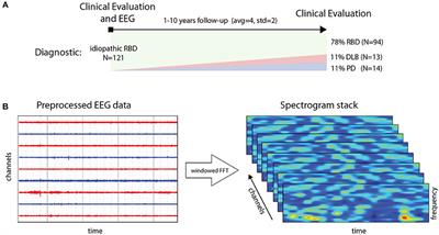 Deep Learning With EEG Spectrograms in Rapid Eye <mark class="highlighted">Movement Behavior</mark> Disorder